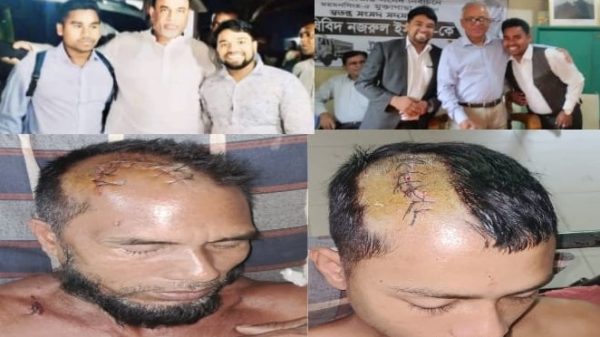 মুক্তাগাছায় নিষিদ্ধ ঘোষিত সংগঠন ছাত্রলীগ নেতা আনিছের নৃশংস হামলার ন্যায় বিচার পাওয়া নিয়ে শংকায় রুহুল ও তার পরিবার